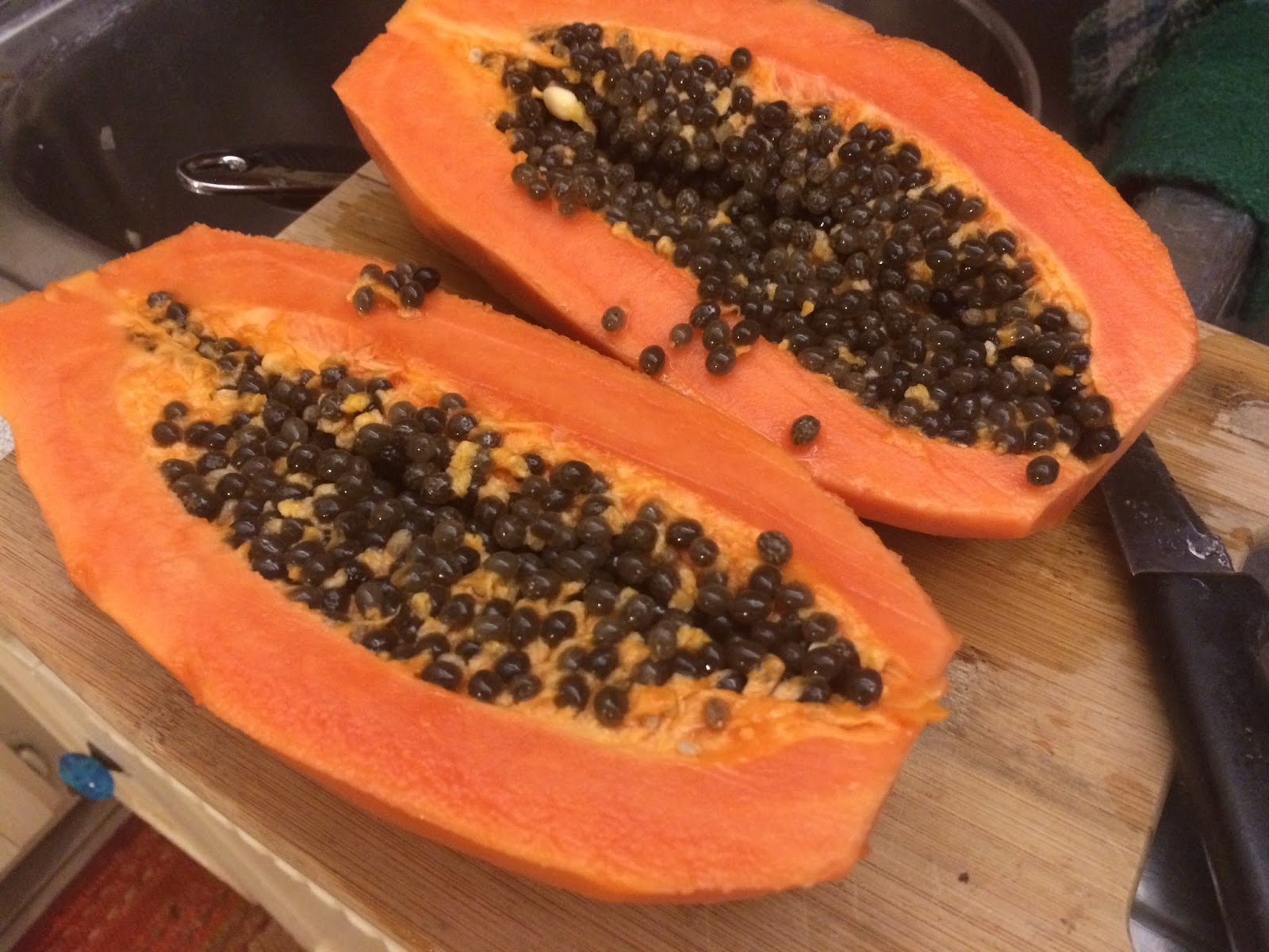 Kevin Songer's Diet for Aorta, Cardiovascular and Gallbladder Health