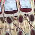 Scientists At Harvard Find Protein In Blood That Reverses Aging