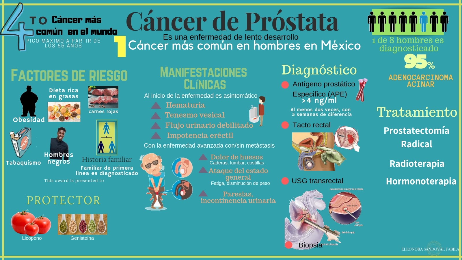 neoplasmas malignos de cáncer de próstata