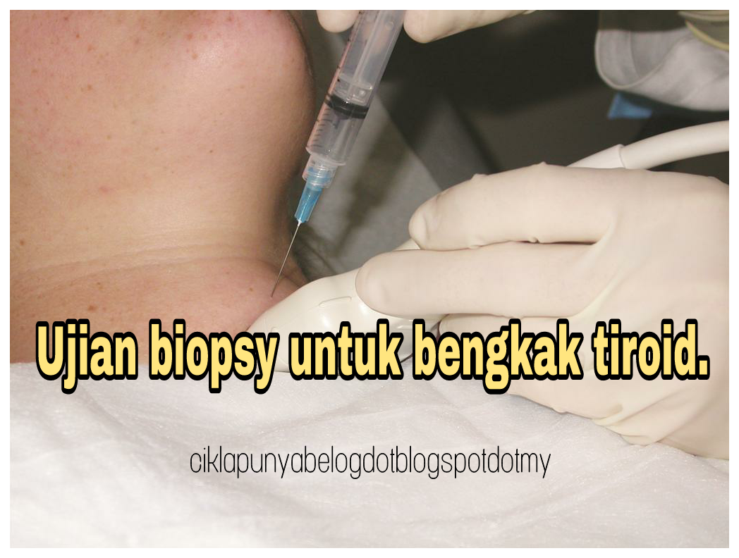 Biopsy di leher