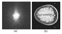 A figure from Intermediate Physics for Medicine and Biology showing an image of the brain and its Fourier transform.