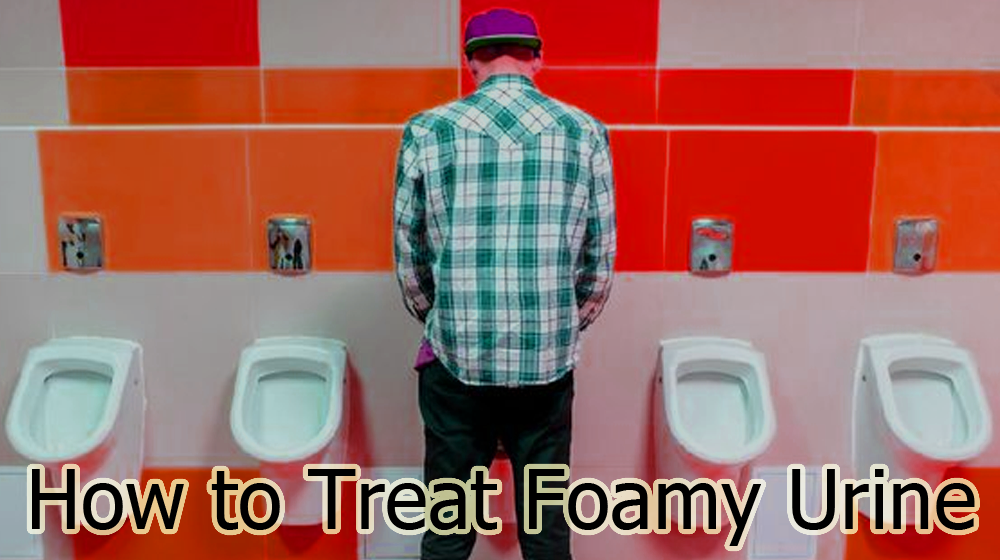 How to Treat Foamy Urine