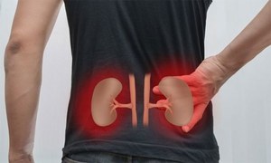 Know These Symptoms of Kidney Failure?