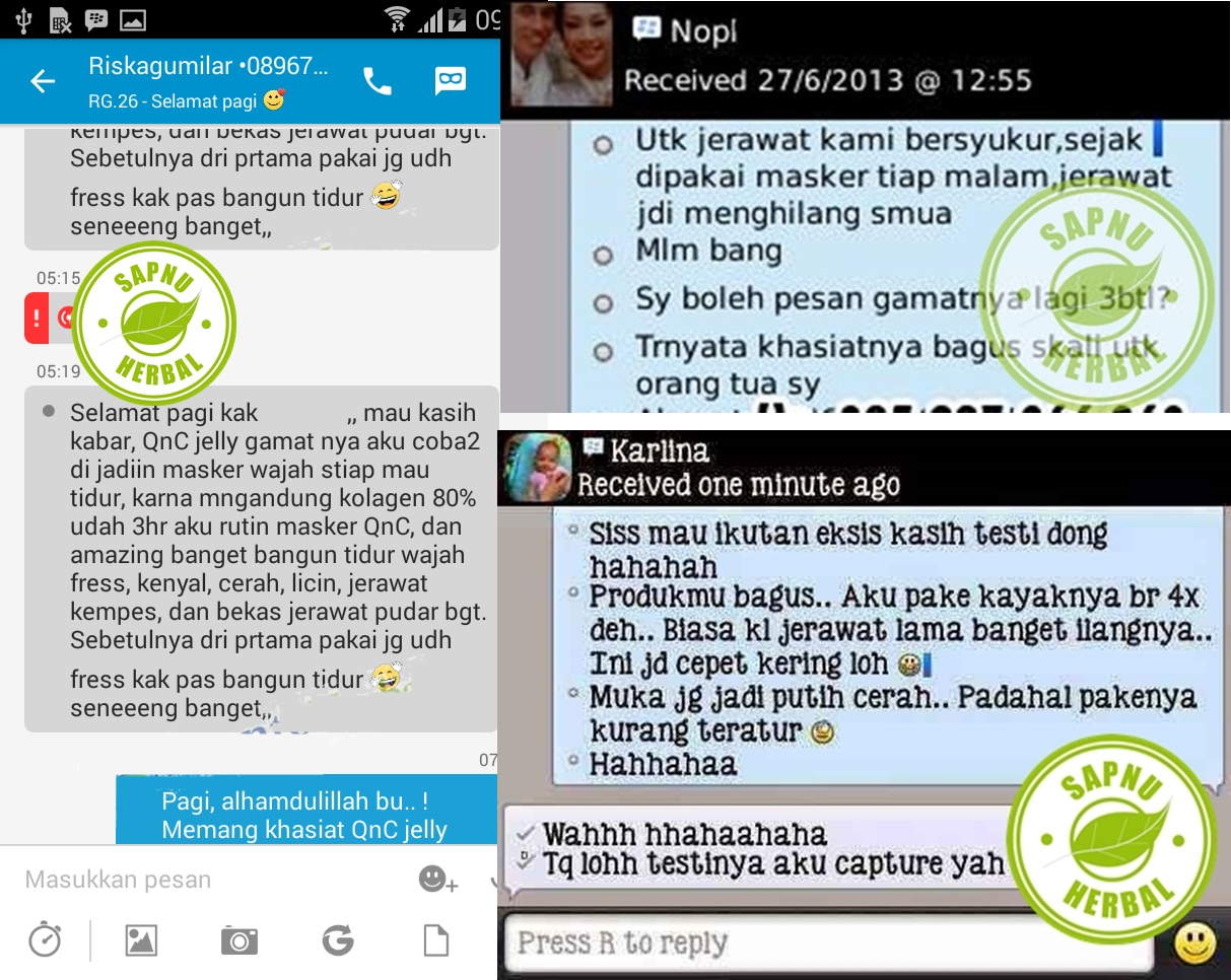 Cara Mengobati Kulit Melepuh