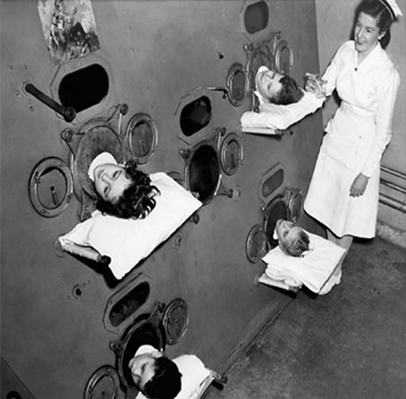 20 Vintage Photos of Iron Lungs for Polio Victims From Between the