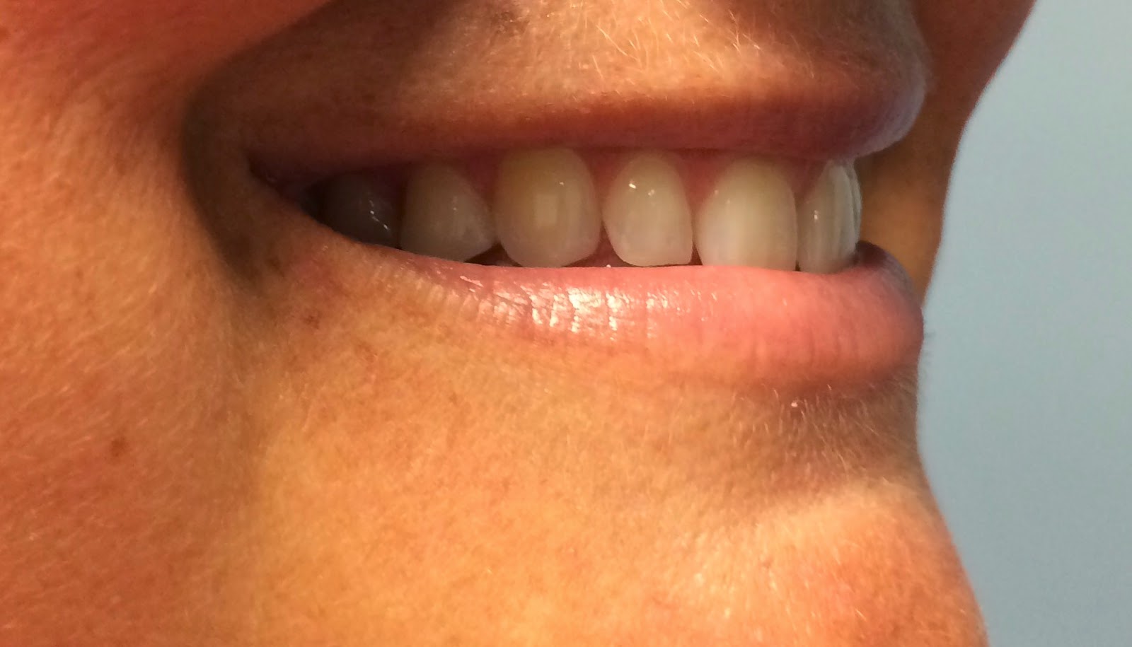 Chip b DDS Clear Correct 'Buttons'