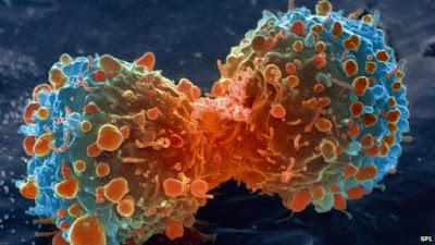 Ung thư được kiểm soát nhờ phát hiện ADN đột biến