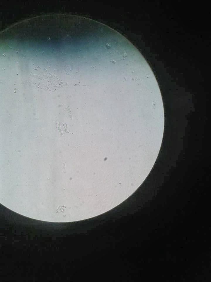 Que son las celulas epiteliales escasas