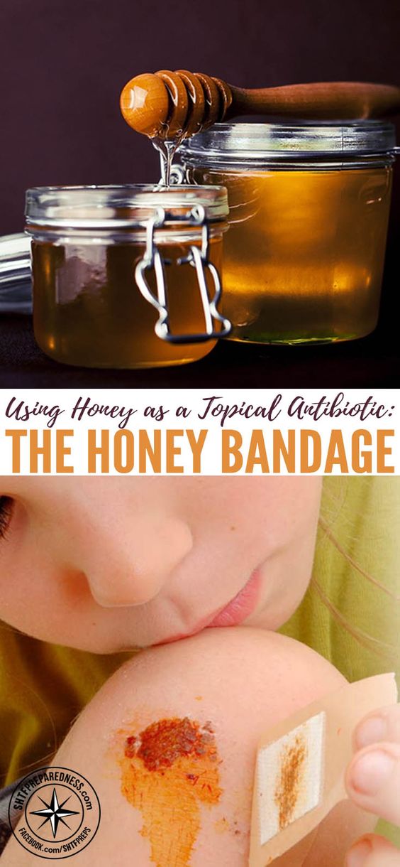 Using Honey as a Topical Antibiotic The Honey Bandage WARM UP