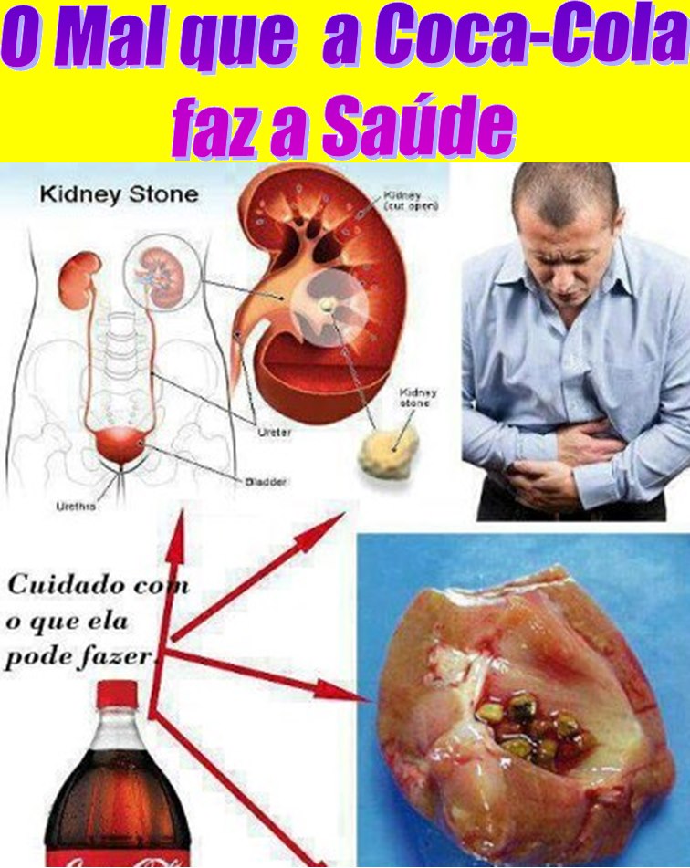 BLOG DO FARINA O MAL QUE A COCACOLA FAZ A SAÚDE BLOG DO FARINA O MAL QUE A COCACOLA FAZ A SAÚDE