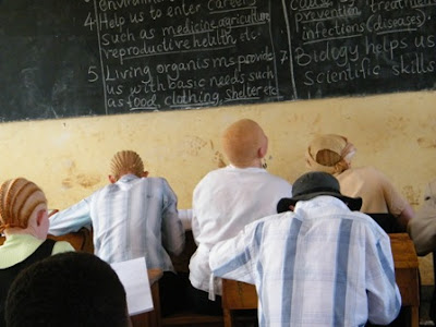 UTME: Albinos To Enjoy 2 Extra Hours In JAMB Examination 1