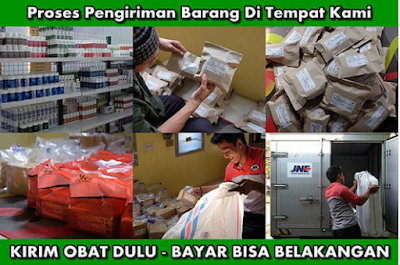 Ciri-Ciri Usus Buntu Dan Cara Mengobatinya
