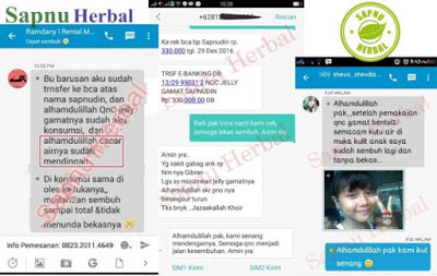 Cara Menyembuhkan Kutu Air Bernanah Yang Membandel Secara Alami Cara Menyembuhkan Kutu Air Bernanah Yang Membandel Secara Alami