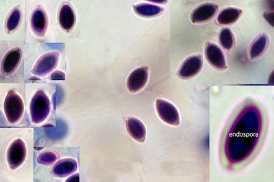 Leucocoprinus brebissonii