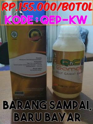 Cara Mengobati Kandung Kemih Turun Pada Wanita