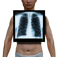 Bir hastaya röntgen çekilmesi