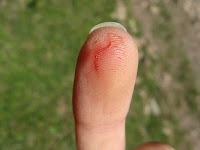 Significado de sonhar com corte