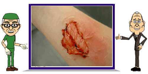 The most effective method to Heal Scabs Fast Heal