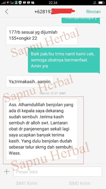 Cara Menyembuhkan Benjolan Di Belakang Lutut Tanpa Operasi Cara Menyembuhkan Benjolan Di Belakang Lutut Tanpa Operasi