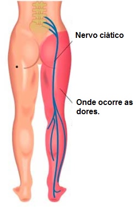 Melhor exercício para perder gordura nas coxas