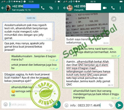 Cara Menghilangkan Benjolan Lunak Di Pangkal Lidah Cara Menghilangkan Benjolan Lunak Di Pangkal Lidah