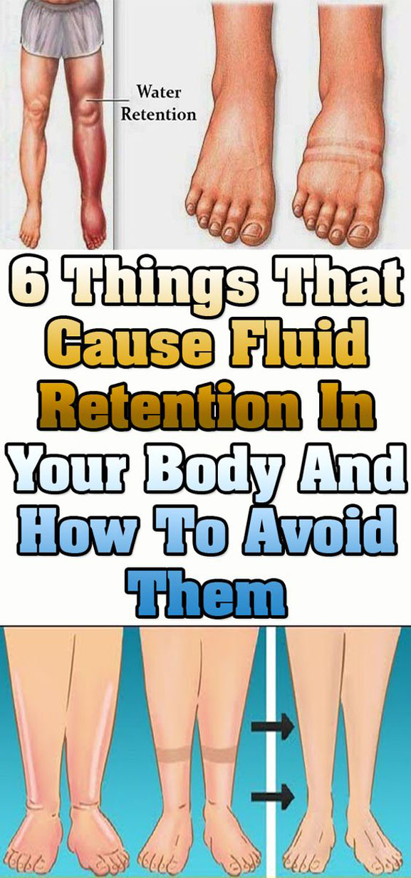 6 Things That Cause Fluid Retention In Your Body And How To Avoid Them