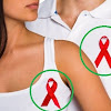 Cara Merawat Penderita HIV dan AIDS