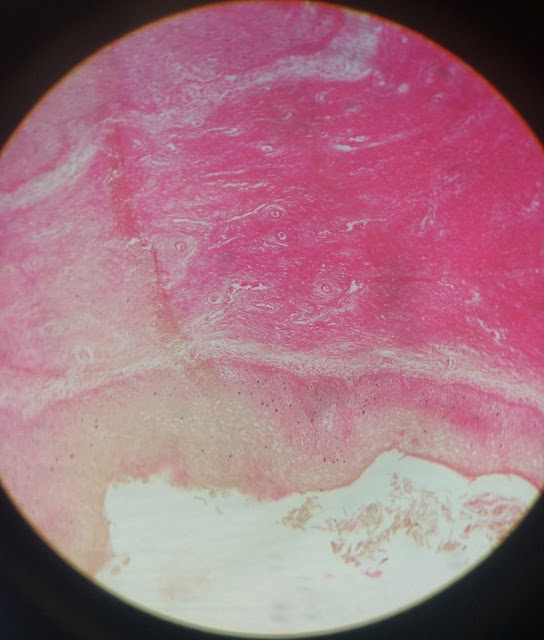 histology slide of cervix