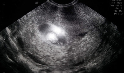 Sonogram