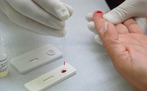 Número de mortes por Aids tem redução de 7,2% na Bahia