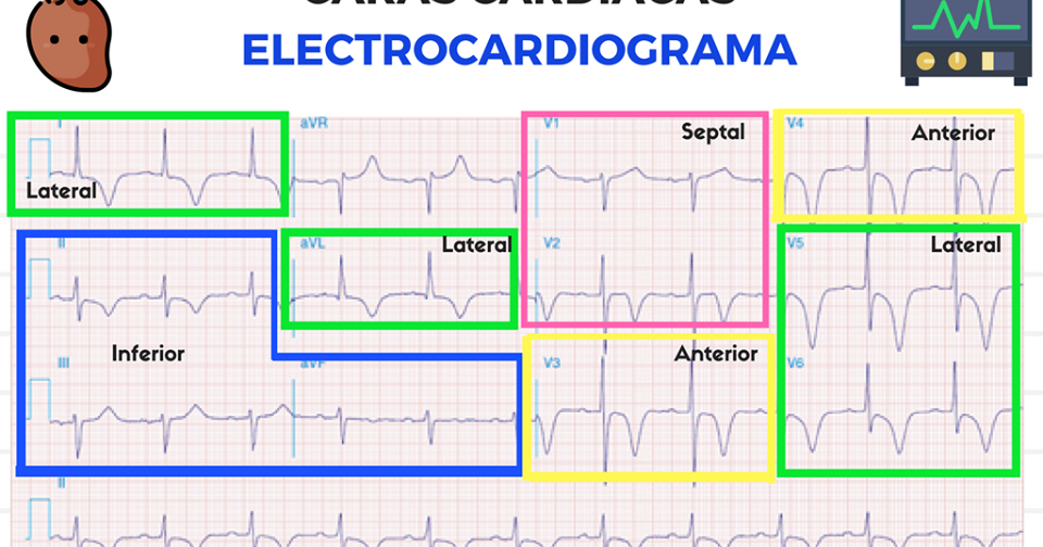 Como hacer un electrocardiograma