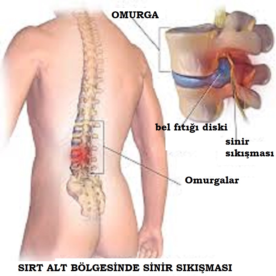 Romatizma Neden Olur Romatizma Neden Olur