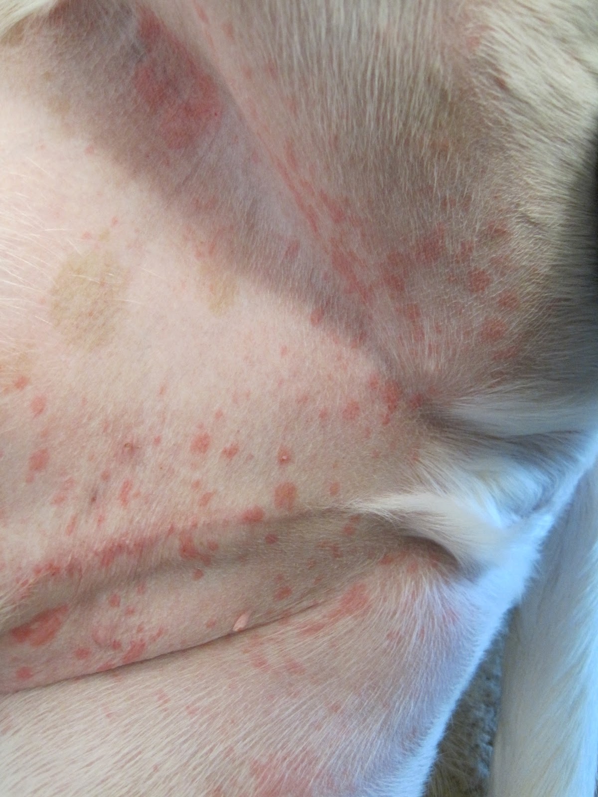 Milady'S Mystery Solved? Staph Bacteria Holds The Key! - styzzbu