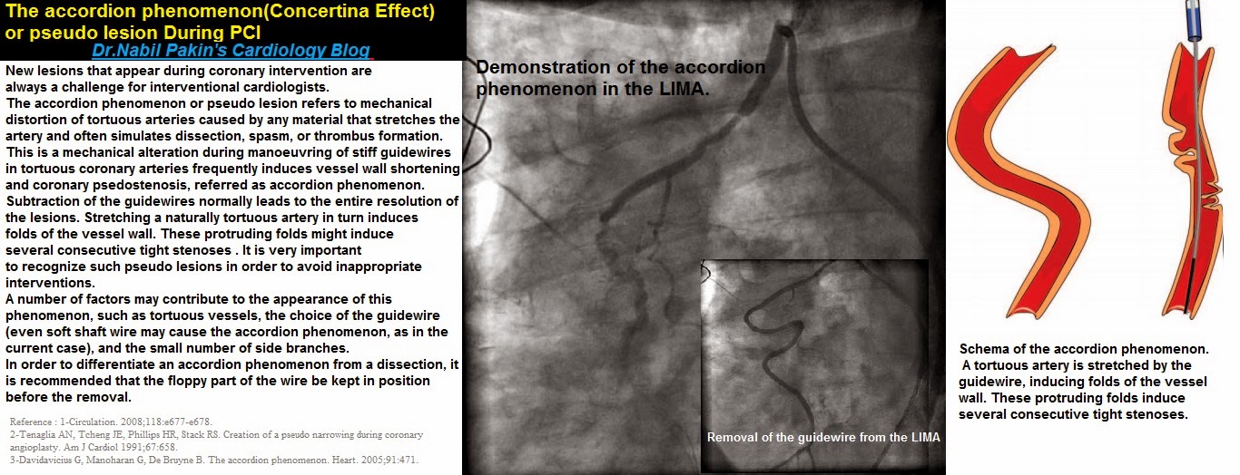 Dr.Nabil Paktin's Journal of Cardiovascular Medicine Blog ژورنال ( قلب و رگ) دکتور نبــیل