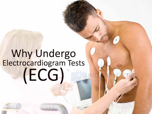 Electrocardiogram Tests (ECG)