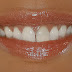 13 Intresting Facts About Your Teeth