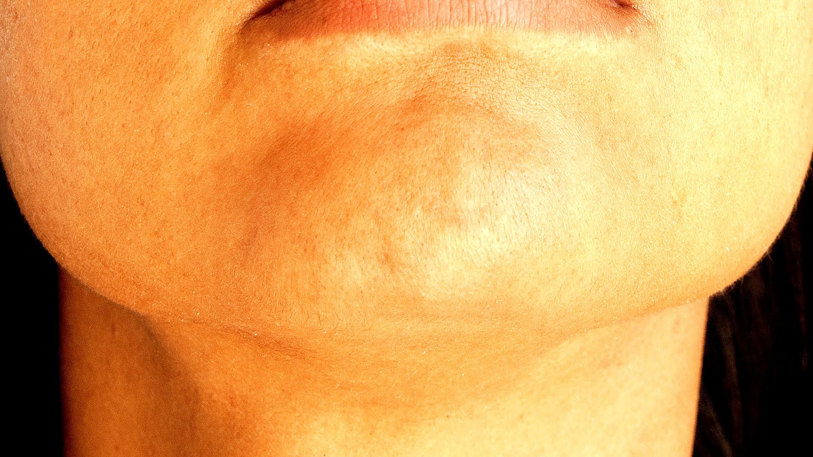 Menopause Dry Itchy Skin Menopause Choices