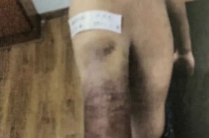 이미지에 대체텍스트 속성이 없습니다; 파일명은 hroa58h3siq47m913ujb.jpg 입니다.