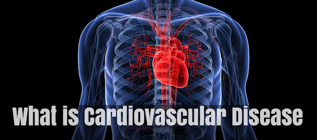 What is Cardiovascular Disease What is Cardiovascular Disease
