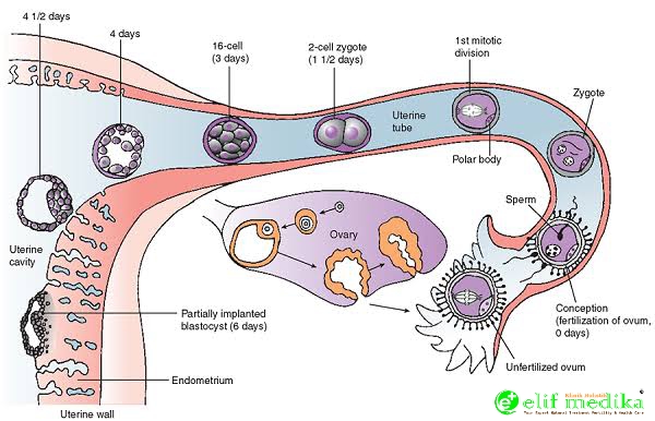 Embriologi sempurna sampai terjadinya implantasi hasil pertemuan sel sperma dan sel telur normal Embriologi sempurna sampai terjadinya implantasi hasil pertemuan sel sperma dan sel telur normal