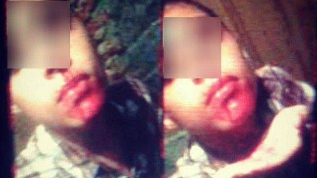 ‘Me enforcou e socou minha boca’, diz jovem de 16 anos sobre homofobia do pai