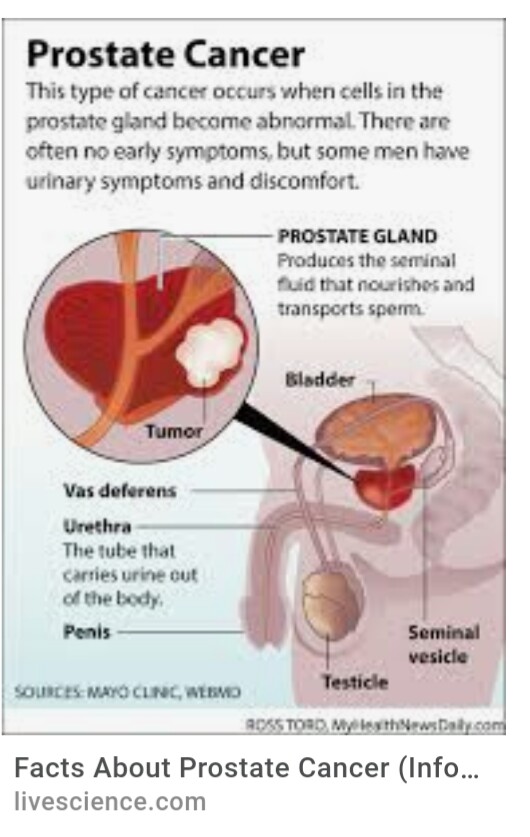 Aspirin and Reduced Risk of Dying From Prostate Cancer HEALTHY AND LIVELY