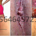 Cara Ngempesin Benjolan Di Anus Karena Wasir thumbnail