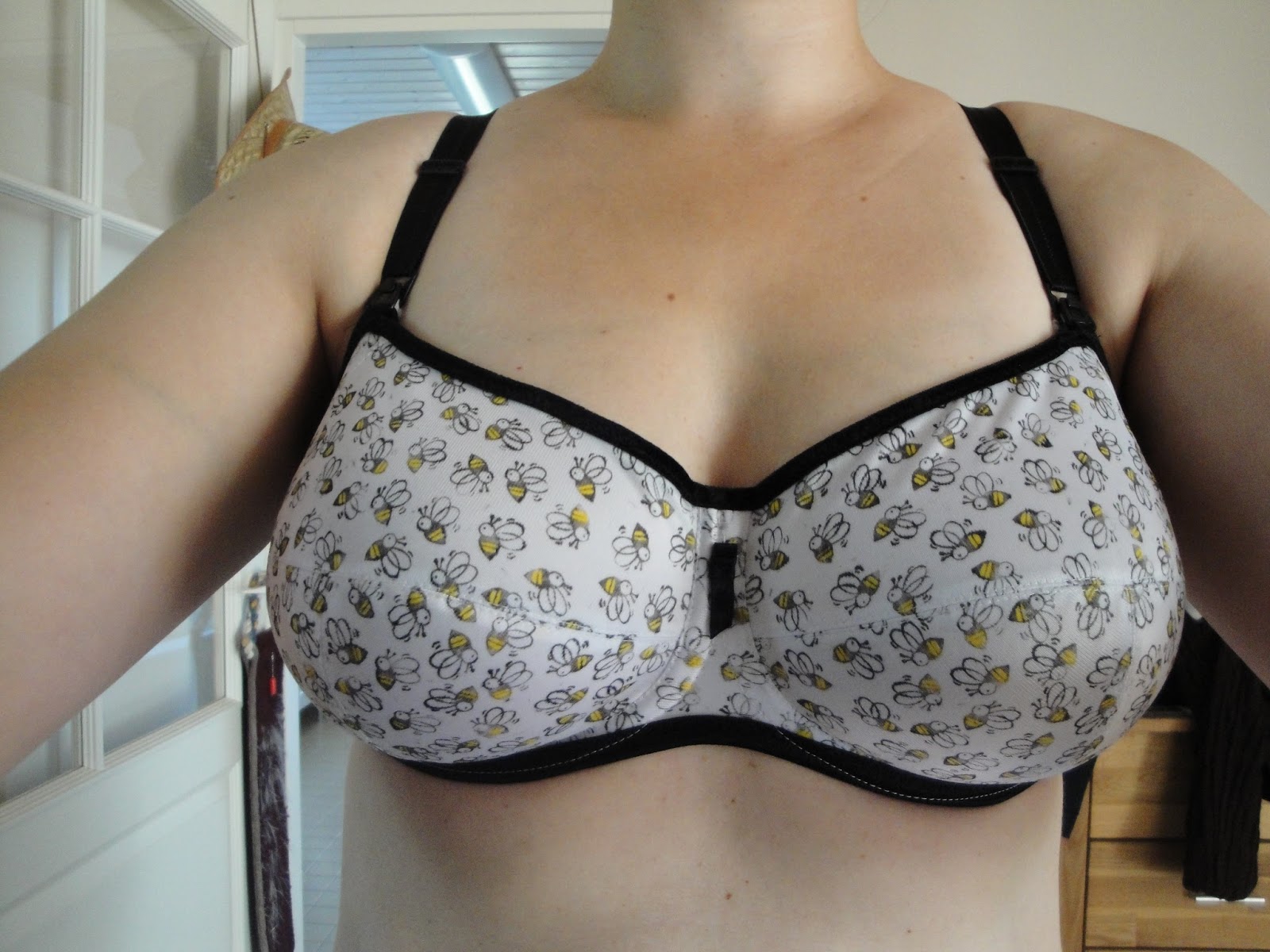 Bras have left a permanent dark imprint where they sit; how can I