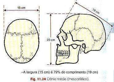 Sintonize na Radiologia: Seios da Face e Cranio