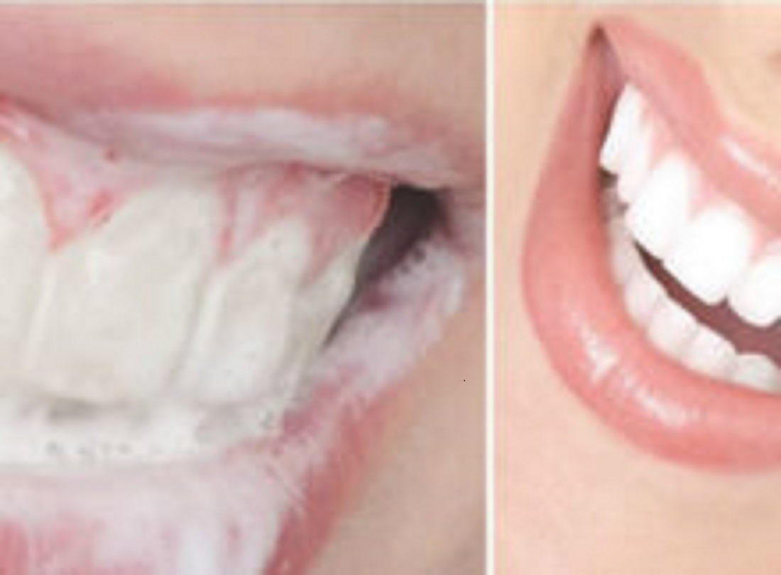 Take Of Your Own Health HOMEMADE RECIPE TO ELIMINATE TARTAR