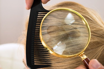 6 bénéfices de l'aloe vera pour vos cheveux 6 bénéfices de l'aloe vera pour vos cheveux