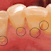COCONUT OIL CAN MIRACULOUSLY SOLVE ALL YOUR TEETH PROBLEMS AND SAVE YOU TONS OF MONEY