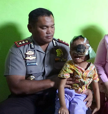 Firda bocah penderita kanker mata semasa hidup saat dipangku Kapolres Asahan Firda bocah penderita kanker mata semasa hidup saat dipangku Kapolres Asahan