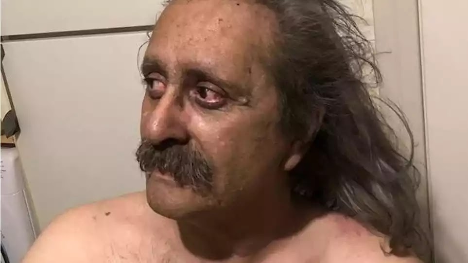 «Θέλω να δικαστούν, δεν μου φτάνει να παραιτηθούν» – Συγκλονίζει η ανάρτηση ενός τυφλού επιζήσαντα στο Μάτι «Θέλω να δικαστούν, δεν μου φτάνει να παραιτηθούν» – Συγκλονίζει η ανάρτηση ενός τυφλού επιζήσαντα στο Μάτι